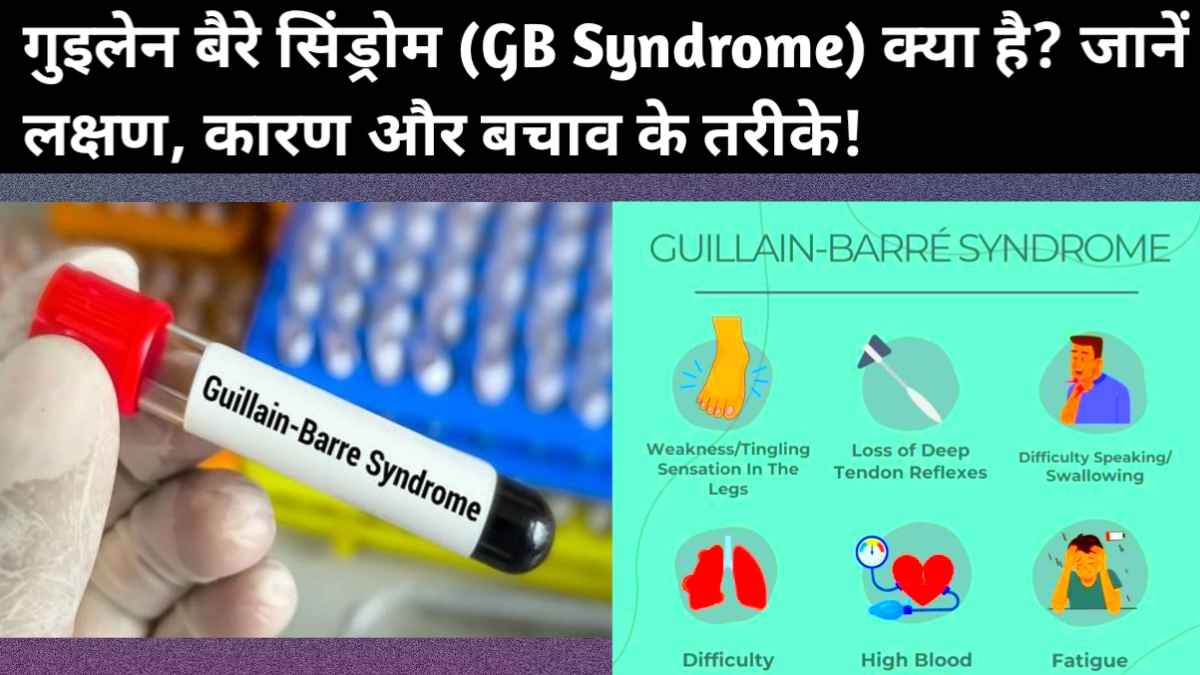 गुइलेन बैरे सिंड्रोम (GB Syndrome)
